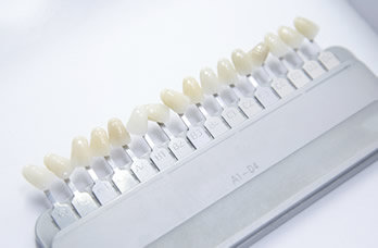 Porcelain Veneers