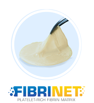 FIBRINET